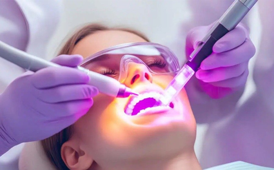 Laser Dental Soft Tissue Therapy
