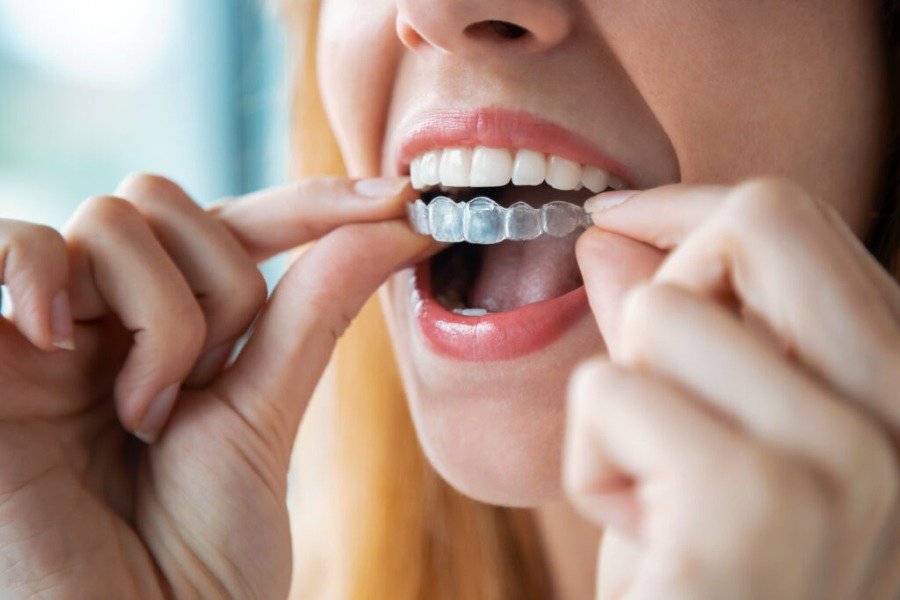 Retainers