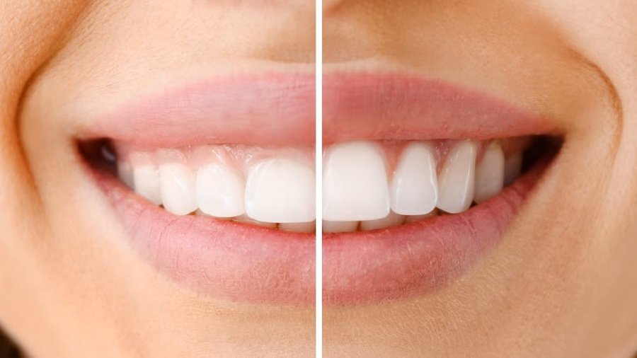 Periodontics Gum Disease Treatment
