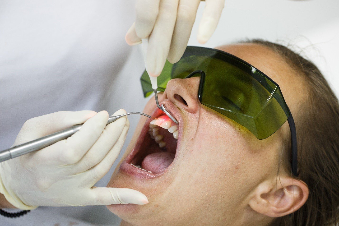 Laser Crown Lengthening