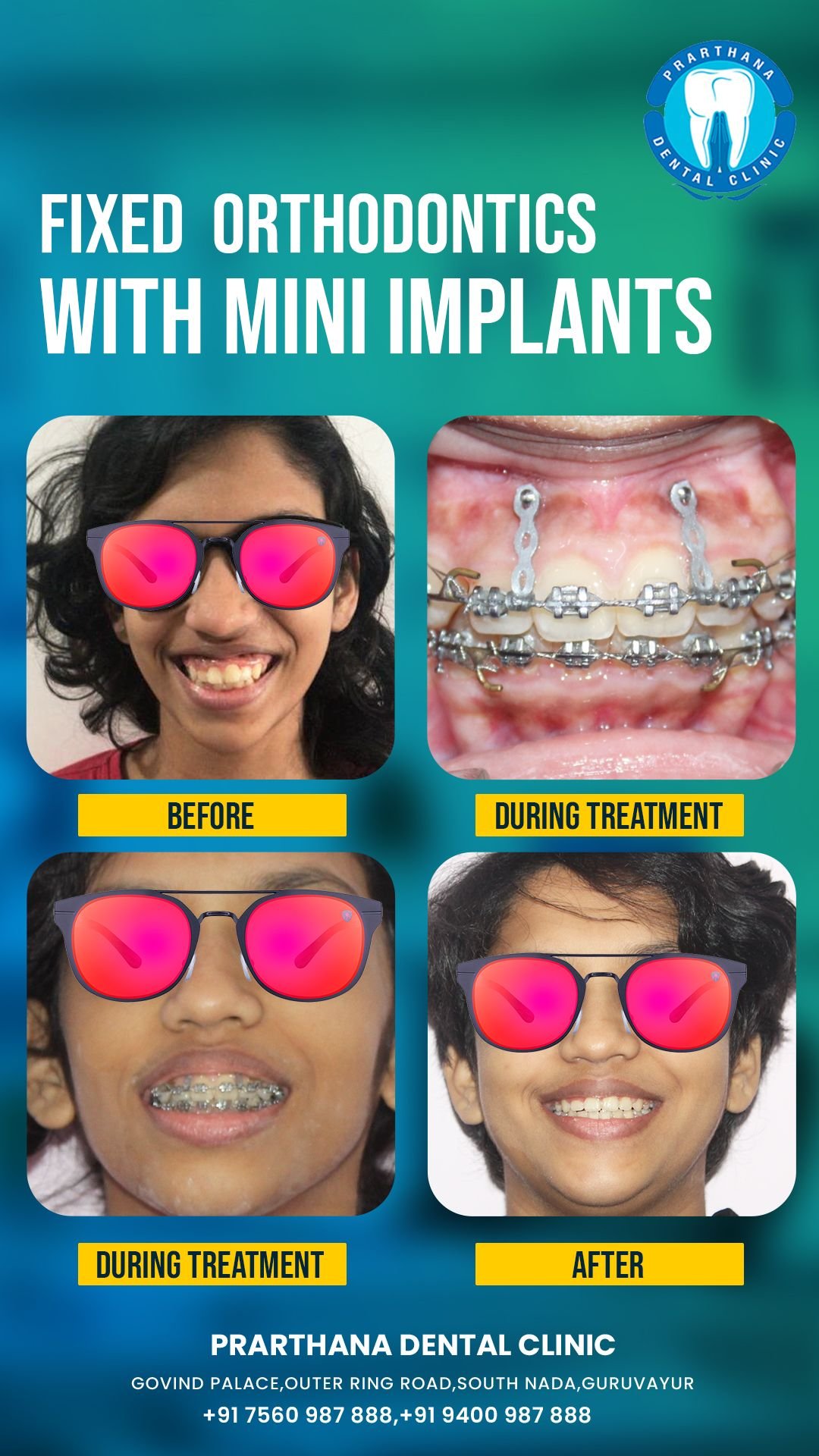 Orthodontic Realignment Transformation