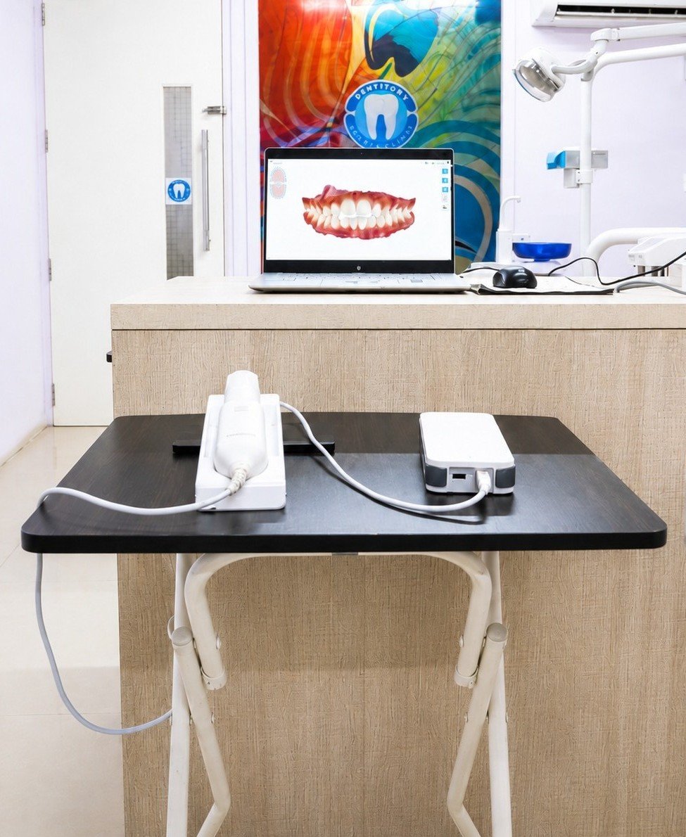 3D Intraoral Digital Scanner